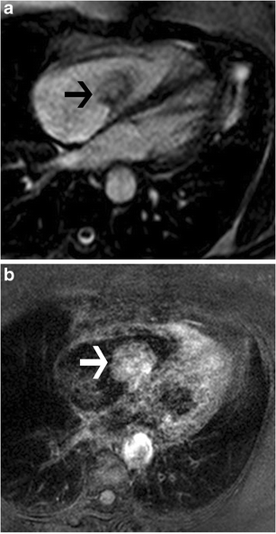 figure 24