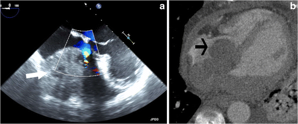 figure 27