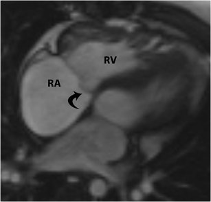 figure 28