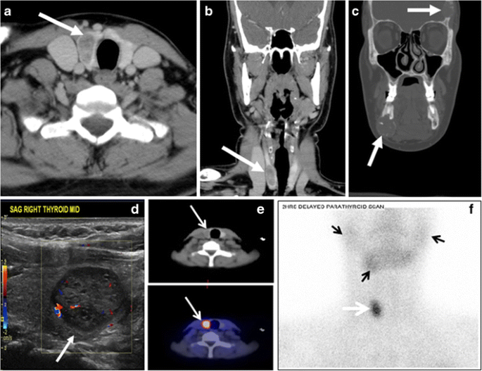 figure 22