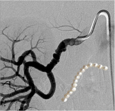 figure 15