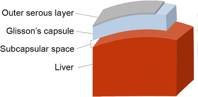 Causes of hepatic capsular retraction: a pictorial essay | Insights into  Imaging | Full Text