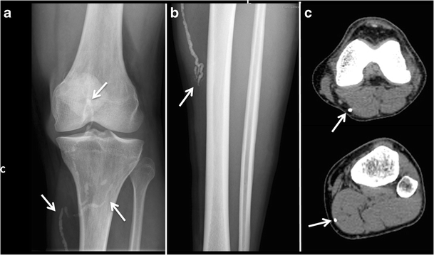 figure 16