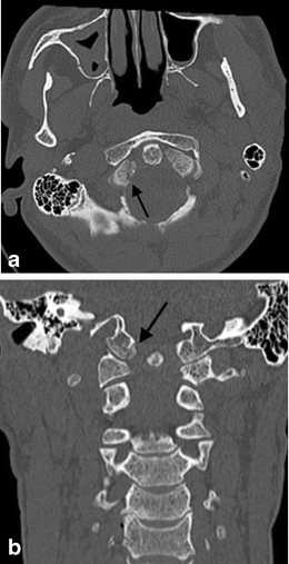 figure 15