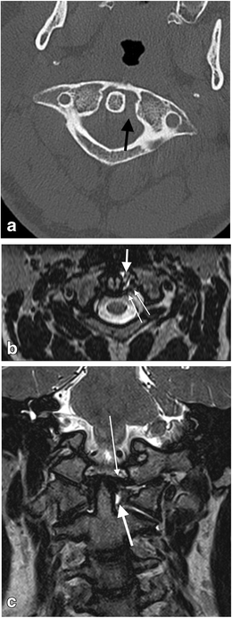 figure 21