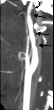 figure 23