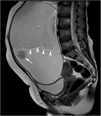 figure 18