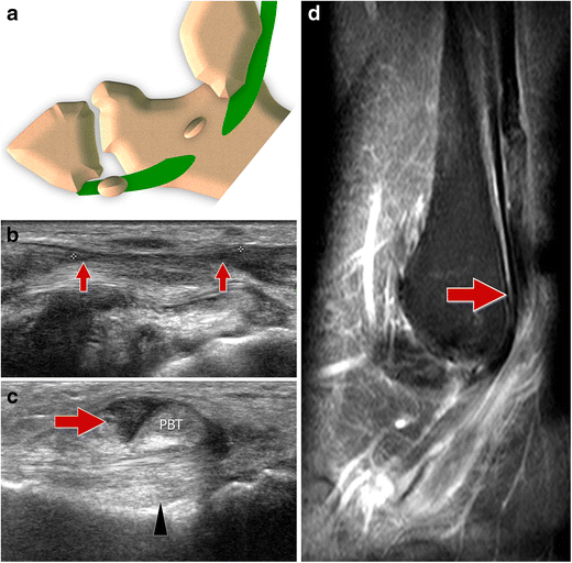  figure12