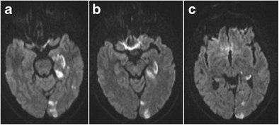 figure 21