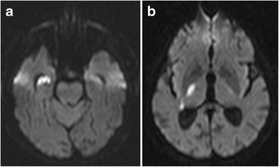 figure 22