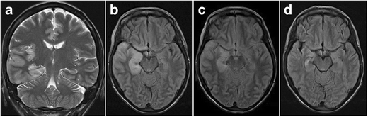 figure 24