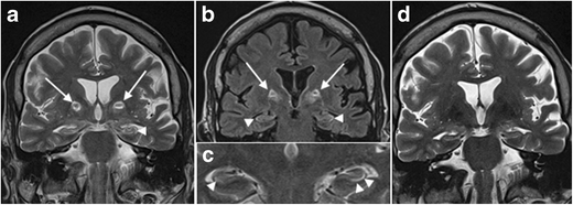 figure 26