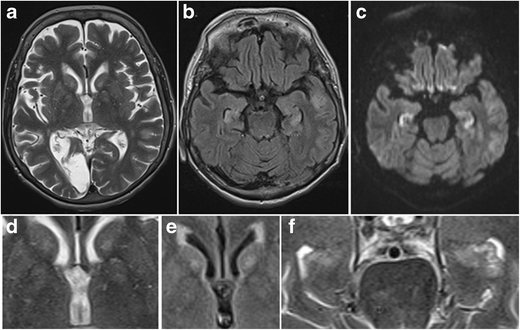 figure 27