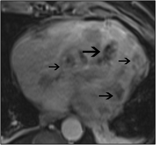 figure 15