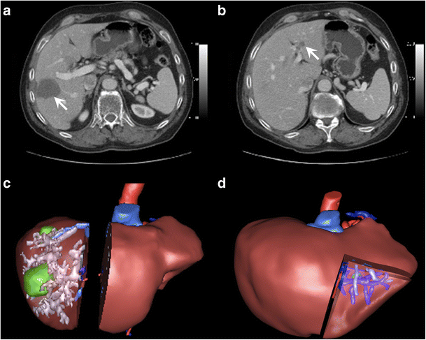 figure 16