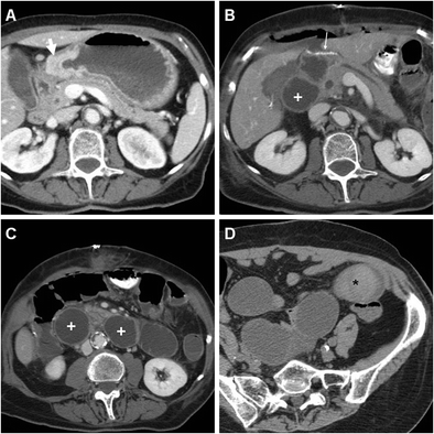 figure 15