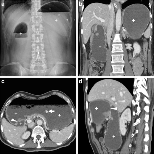 figure 15