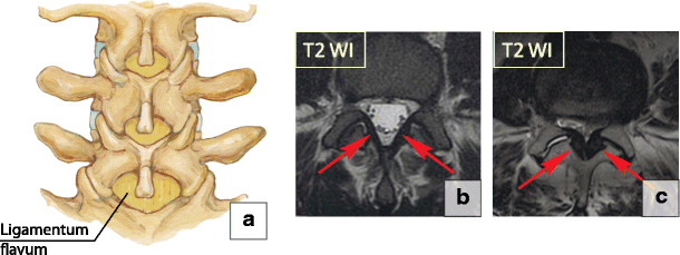 figure 26