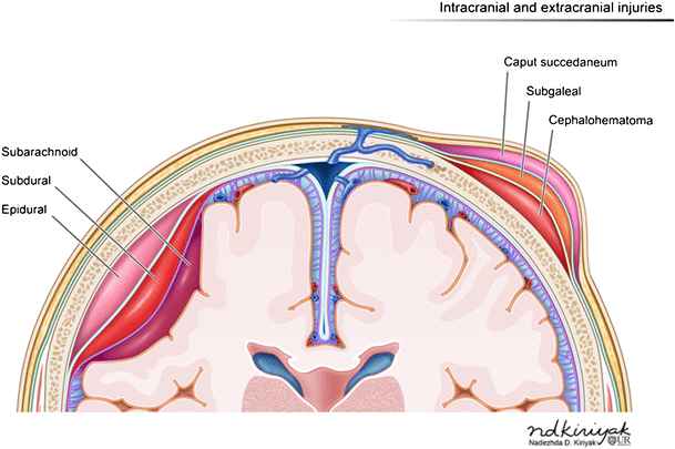 caput succedaneum ultrasound