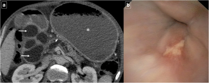 figure 17