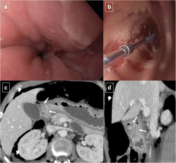 figure 18