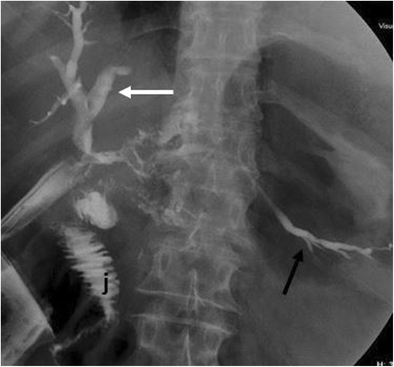 figure 25