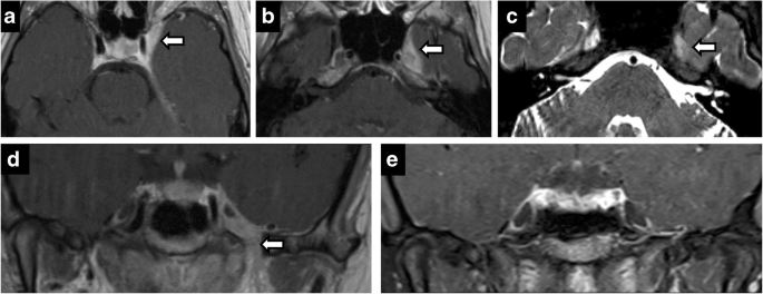 figure16