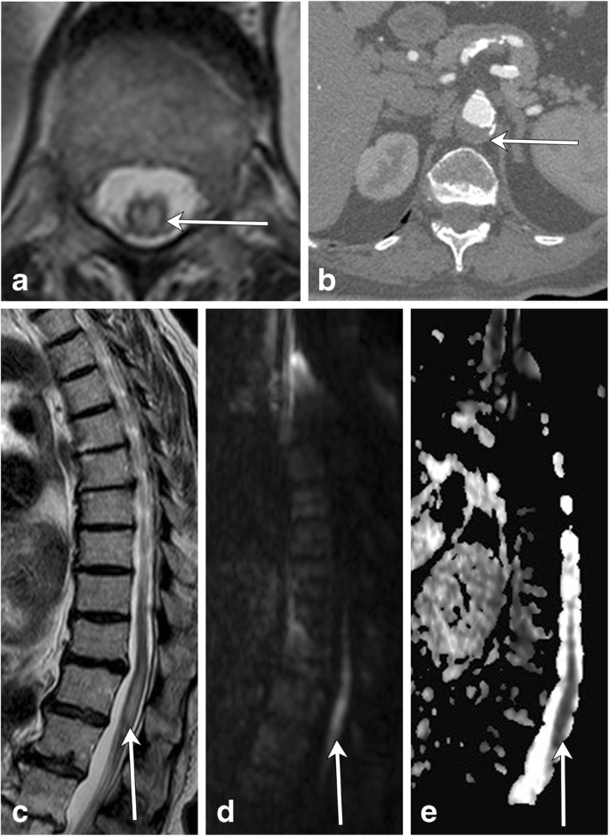 figure 22