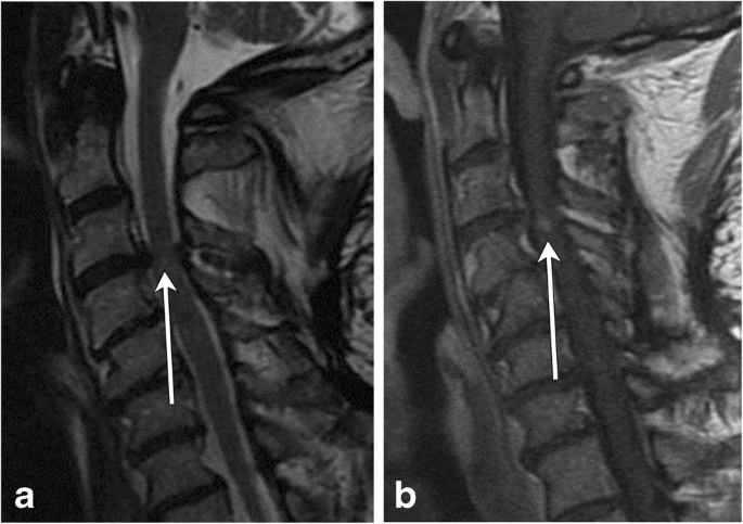 figure 23