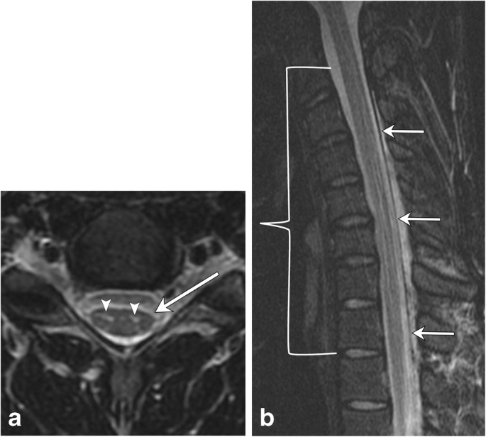 figure 24