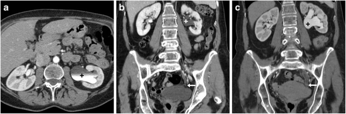 figure 15