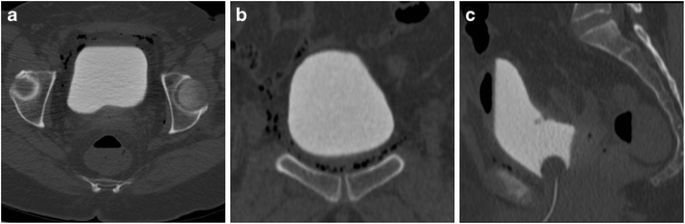 figure 16