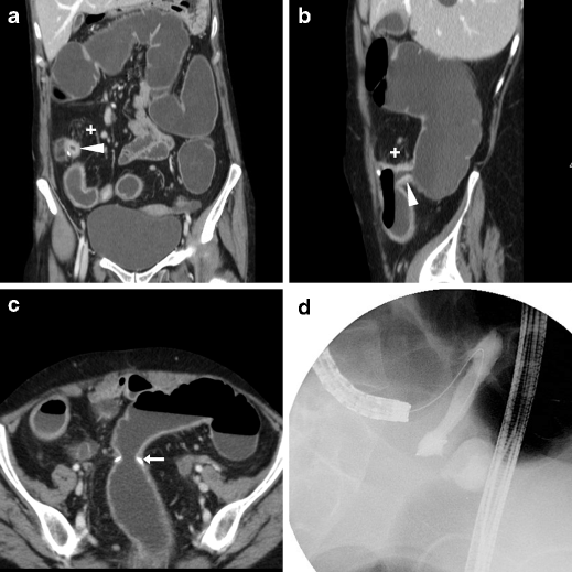 figure 15