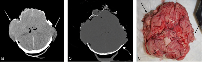 figure 15