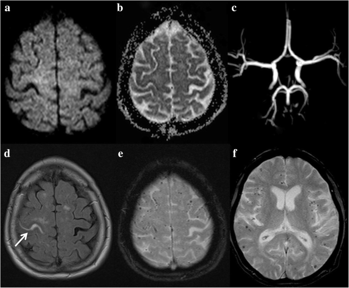 figure 14