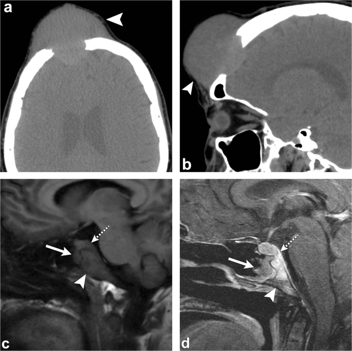 figure 18