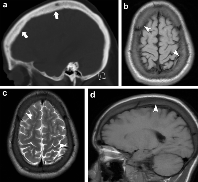 figure 21