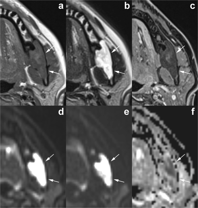 figure 15