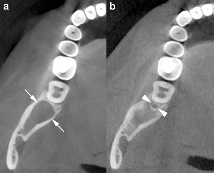 figure 18