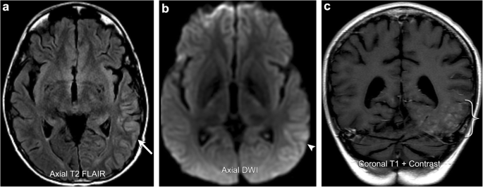 figure 15