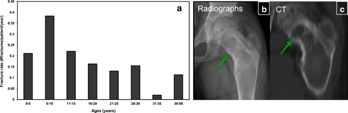 figure 15