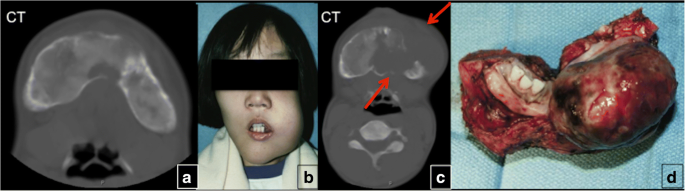 figure 18