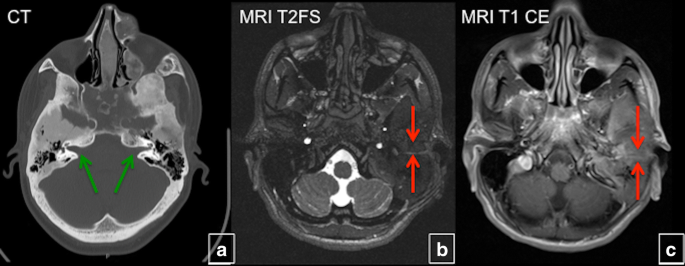 figure 20