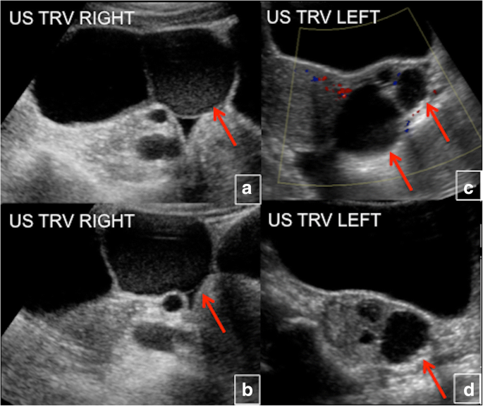 figure 24