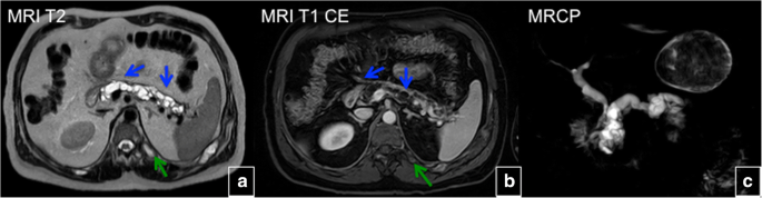 figure 28