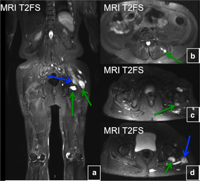 figure 29