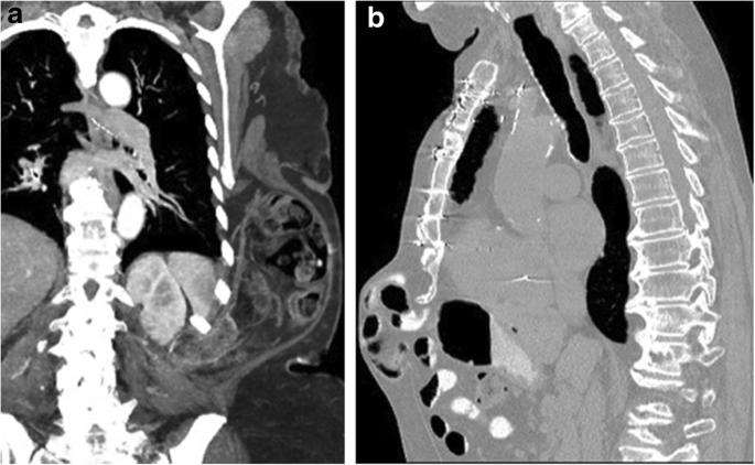 figure 18