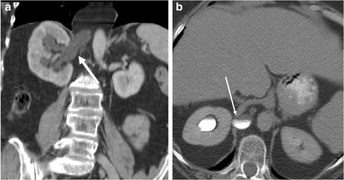 figure 23