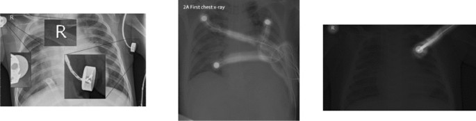 figure4