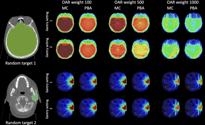 Virtual-simulation boosted neural network dose calculation engine for ...